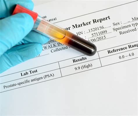 hris.psa|valore psa alto quando preoccuparsi.